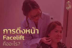 การดึงหน้า คือ